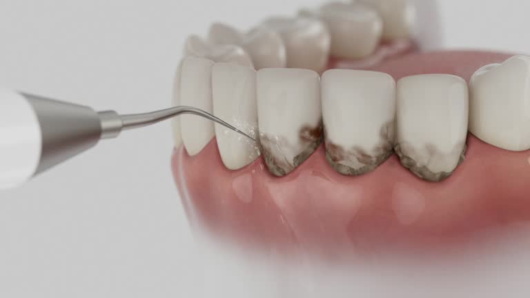 Trusted Teeth Cleaning And Checkup service in Seguin, TX - Dentist Open Now